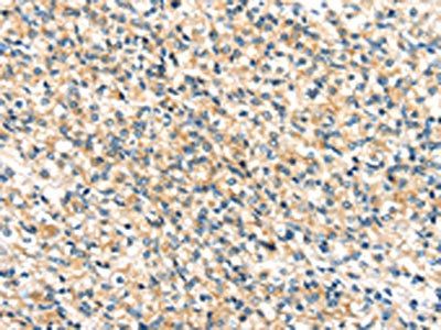 TTI1 Antibody
