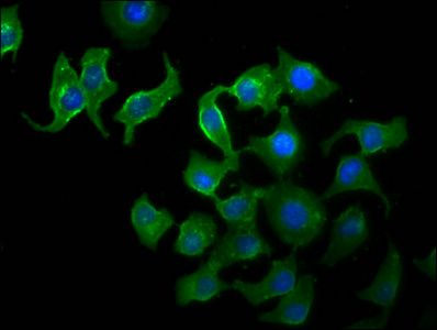 TTI2 antibody