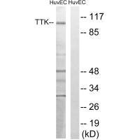 TTK (Ab-676) antibody