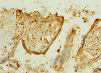 TTLL2 Antibody