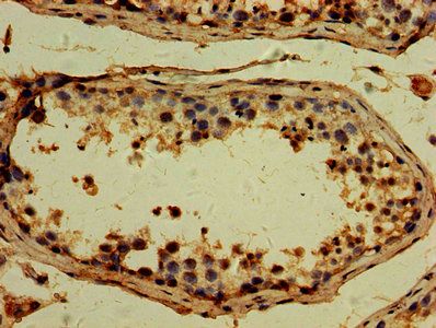 TTLL6 Antibody