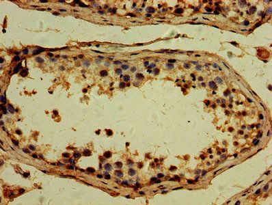 TTLL6 antibody