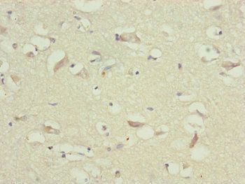 TTLL7 Antibody