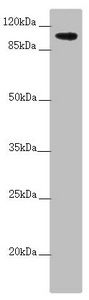 TTLL7 antibody