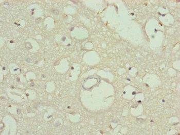 TTLL7 Antibody