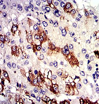 TUBA8 Antibody