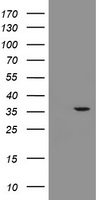 TUBAL3 Antibody