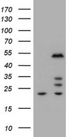 TUBB1 Antibody