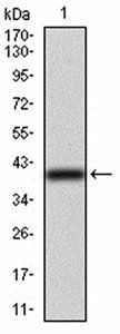 TUBB1 Antibody