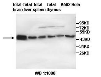 TUBB3 Rabbit Polyclonal Antibody