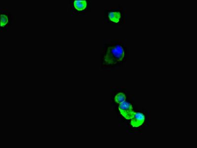 TUBB4A Antibody