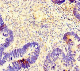 TUBB4A Antibody