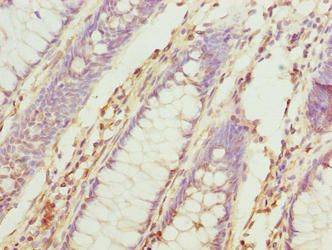 TUBB6 Antibody