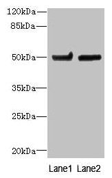 TUBB6 antibody