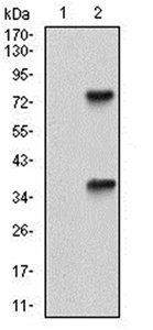 TUBE1 Antibody