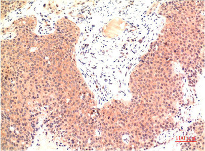 TUBE1 Monoclonal Antibody