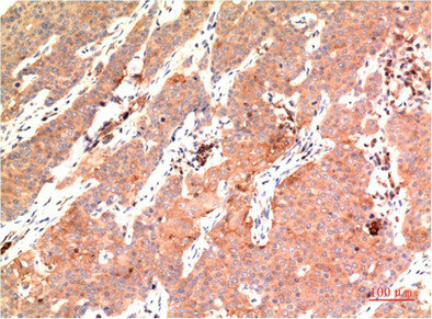 TUBE1 Monoclonal Antibody