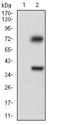 TUBE1 Antibody