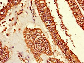 TUBG1 Antibody