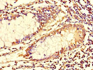 TUBG1 Antibody