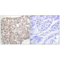 TUBG1 Antibody