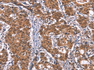 TUBGCP2 Antibody