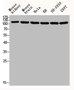 TUBGCP5 Antibody