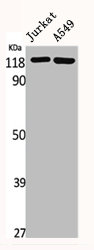 TUBGCP5 Antibody