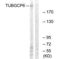 TUBGCP6 Antibody