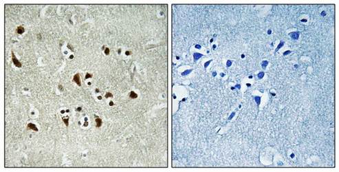 TUBGCP6 Antibody