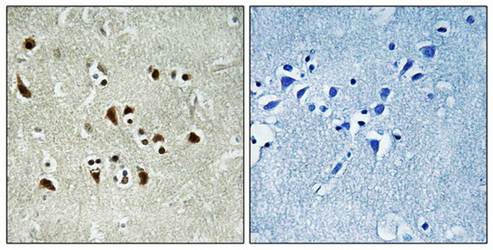 TUBGCP6 antibody