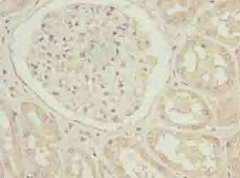TUBB1 Antibody
