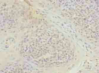 TUBB1 Antibody
