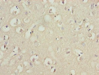 TUBB1 Antibody