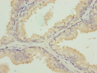 TUBB1 Antibody