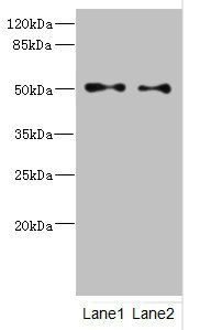 Tubulin beta 3 antibody