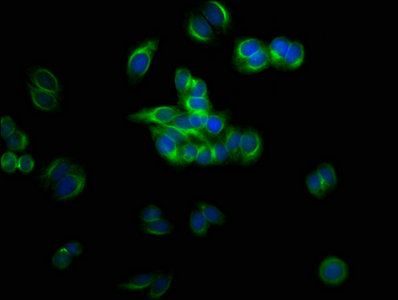 Tubulin beta 3 antibody