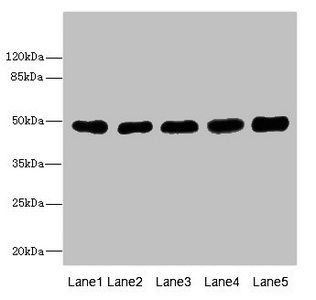 Tubulin beta 3 antibody