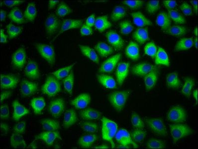 MC1R Antibody