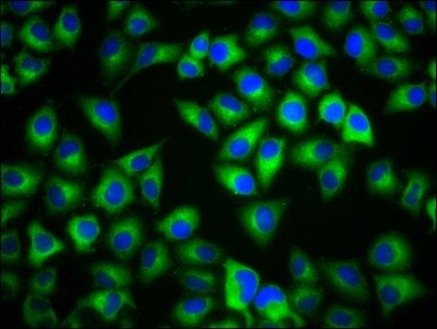 Tubulin beta 3 antibody