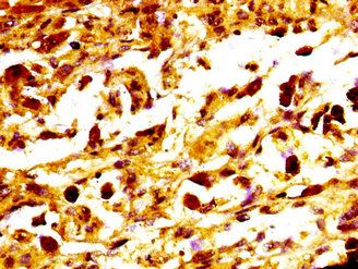 MC1R Antibody