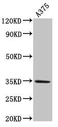 MC1R Antibody