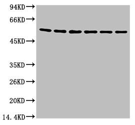 TUBB3 Monoclonal Antibody
