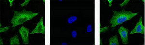 TUBB3 Monoclonal Antibody