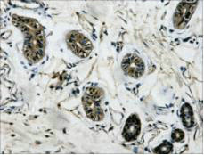 TUBB3 Monoclonal Antibody