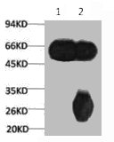 Tubulin beta 3 antibody