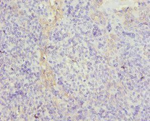 TUBB Antibody