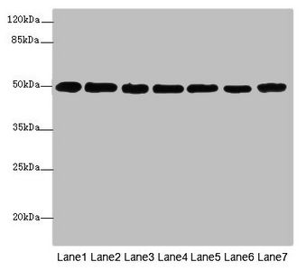 TUBB Antibody