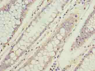 TBCC Antibody
