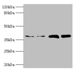 Tubulin-specific chaperone C antibody